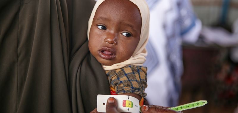A Somalian Child Is Measured For Stunting, A Consequence Of Chronic Malnourishment